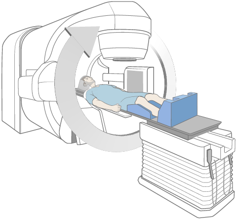 Figura 2. Un ejemplo de una máquina de radioterapia