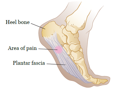 Figure 1. Plantar fascia