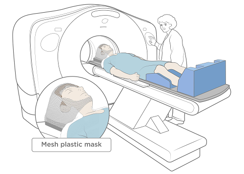 Figura 3. Tomografía computarizada (CT) con mascarilla de malla con orificio para la cara