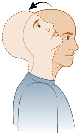 Figura 4. Incline la cabeza hacia atrás