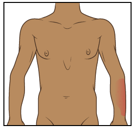 Figura 2. Fotografía de la parte superior del cuerpo tomada a 4 pies de distancia