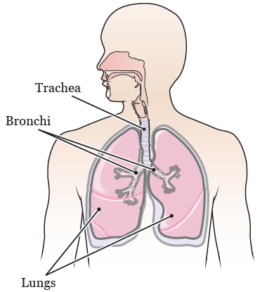 tracheal_bronchial_stent-fig_2a-en.png
