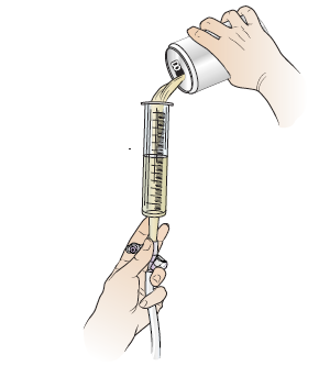 Figure 10. Refill syringe with formula