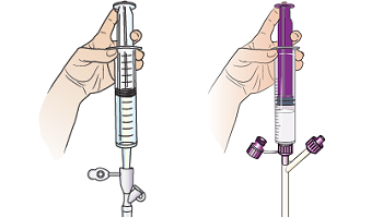 Figure 7. Flushing your feeding tube with legacy connector (left) and ENFit (right) 
