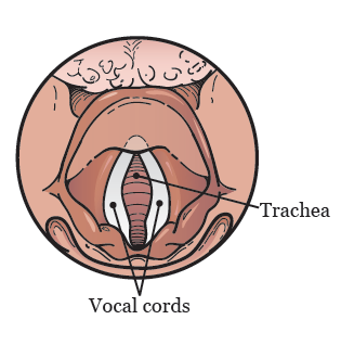Figure 1. Your vocal cords and trachea