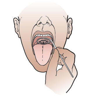 Figure 2. Looking at your vocal cords