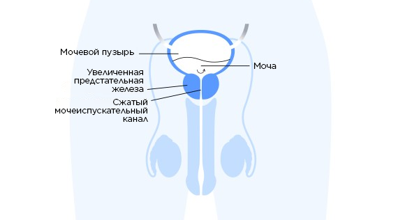 Рисунок 1.  Анатомия предстательной железы 
