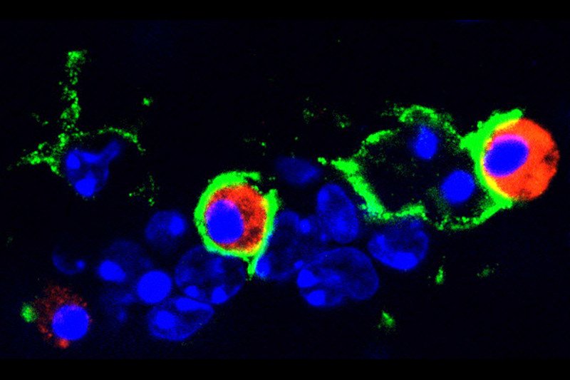 Radiological image of a mouse with glioblastoma.