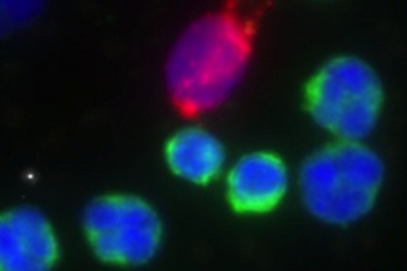 Microscopic image of stained cells, six blue and one red.