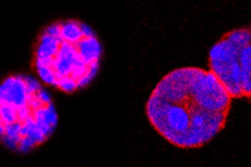 photo of Foxo1 protein stained in regulatory T cells