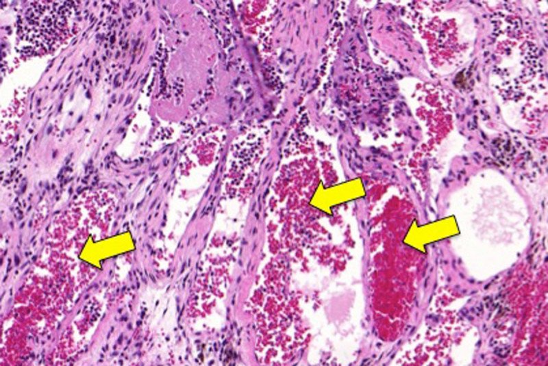 scan of mouse blood vessel