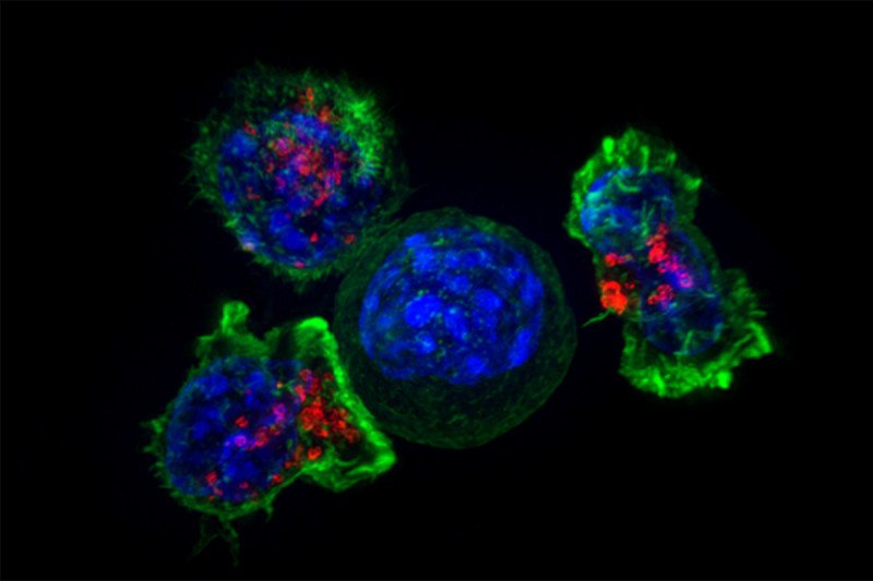 Enlarged microscopic image of blue-green immune cells surrounding one blue cancer cell.