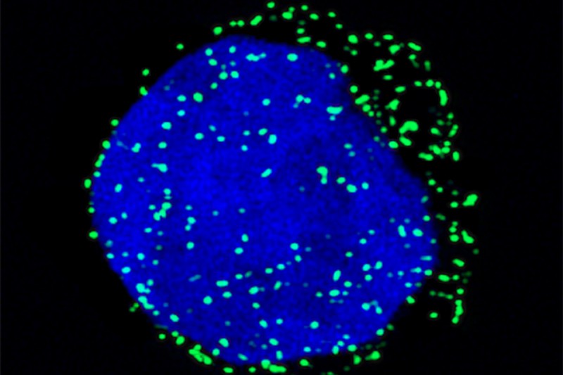 Blue sphere (stem cell) with green dots scattered around the surface