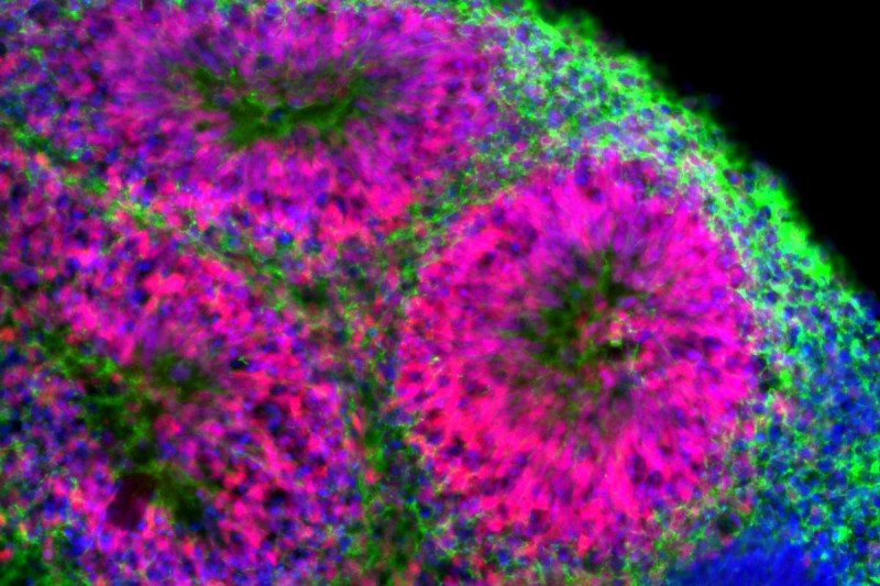 An organoid of a developing brain