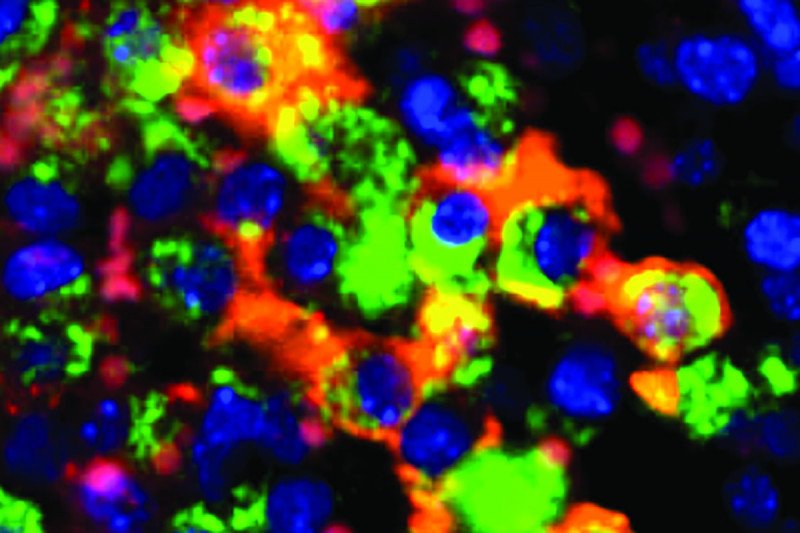MSK-Developed Technology Provides a “Virtual Biopsy” of Immune Cells in ...