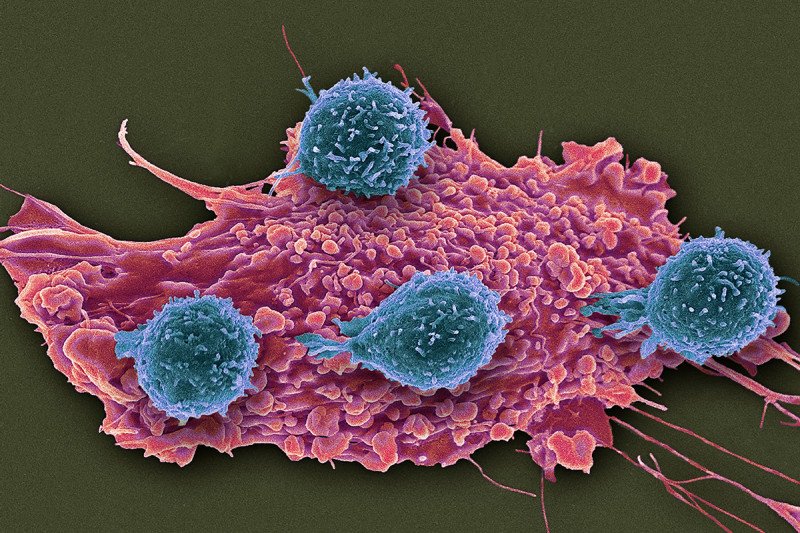 Scanning electron micrograph (SEM) of T lymphocyte cells (blue) attached to a red cancer cell.