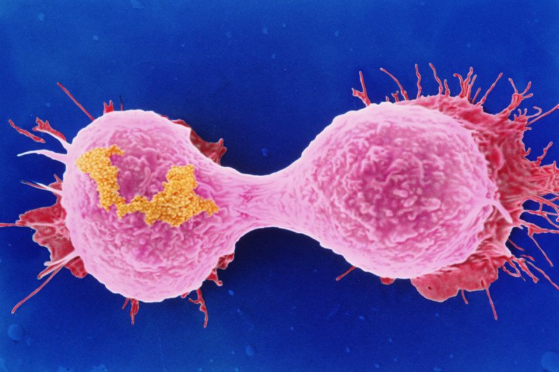 Image of dividing breast cancer cells taken with electron microscope.