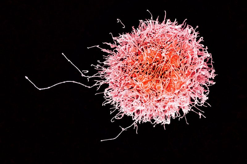 electron micrograph of a natural killer cell