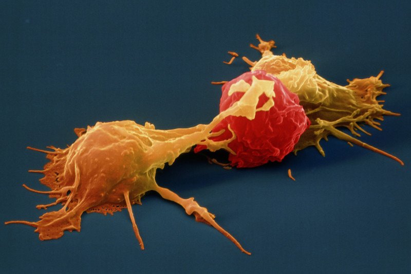 Pictured: Natural Killer Cells & Cancer Cell