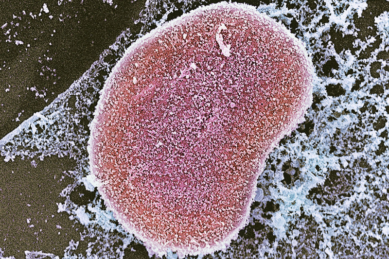 A micrograph of a cell nucleus