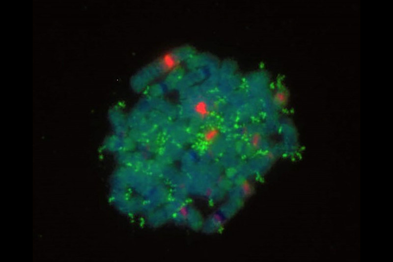 Enlarged image of neuroblastoma cell with stains.