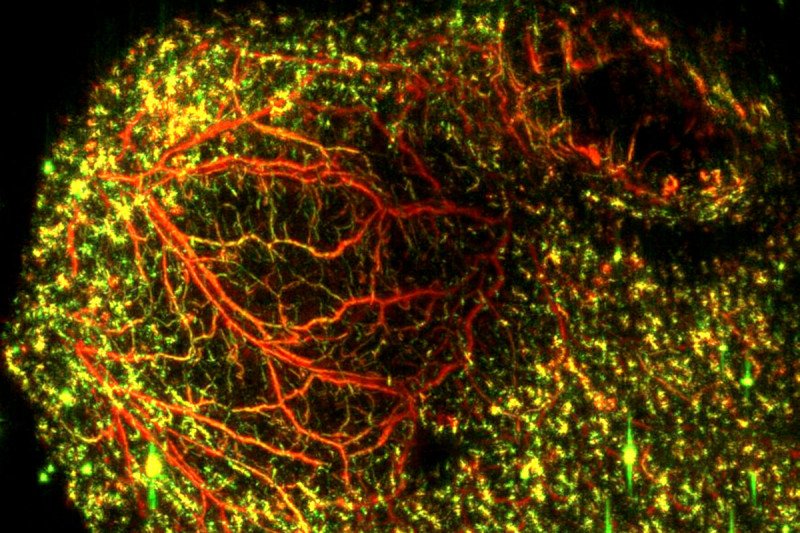 Medical image showing vasculature of colon tumor in mice.