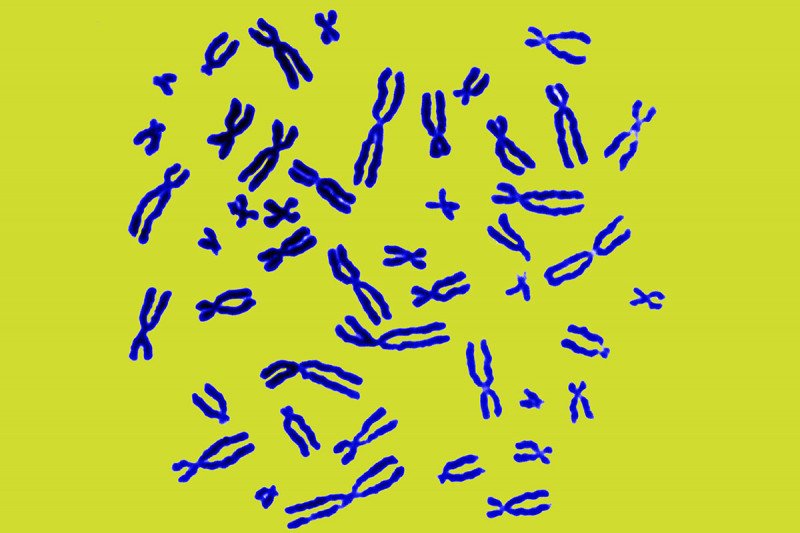 Chromosomes from a human male