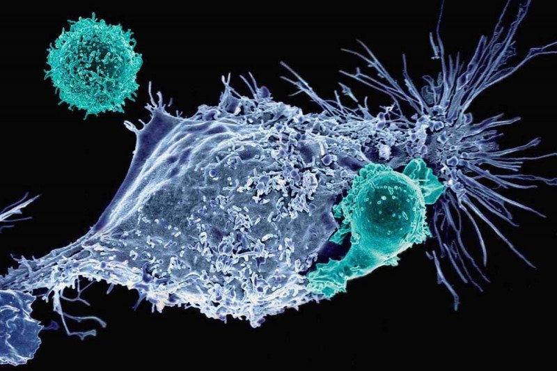 CAR T cells attacking cancer