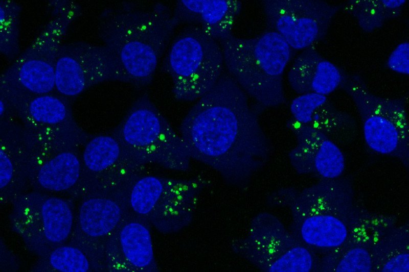 Macropinocytosis