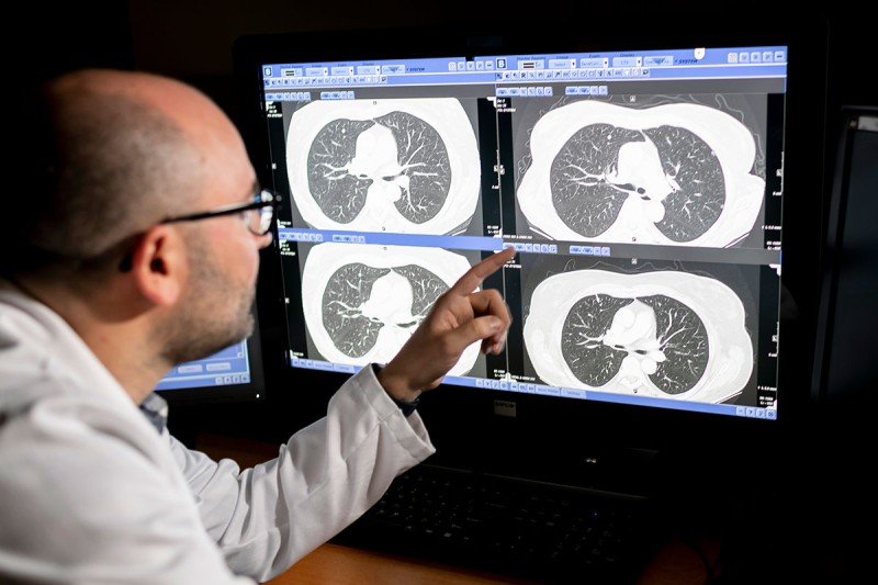 Radiologist Andrew Plodkowski looking at a scan