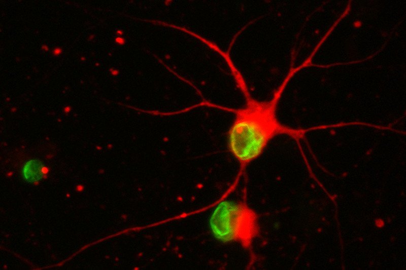 Pictured: Stem cell-derived nerve cells exposed to progerin