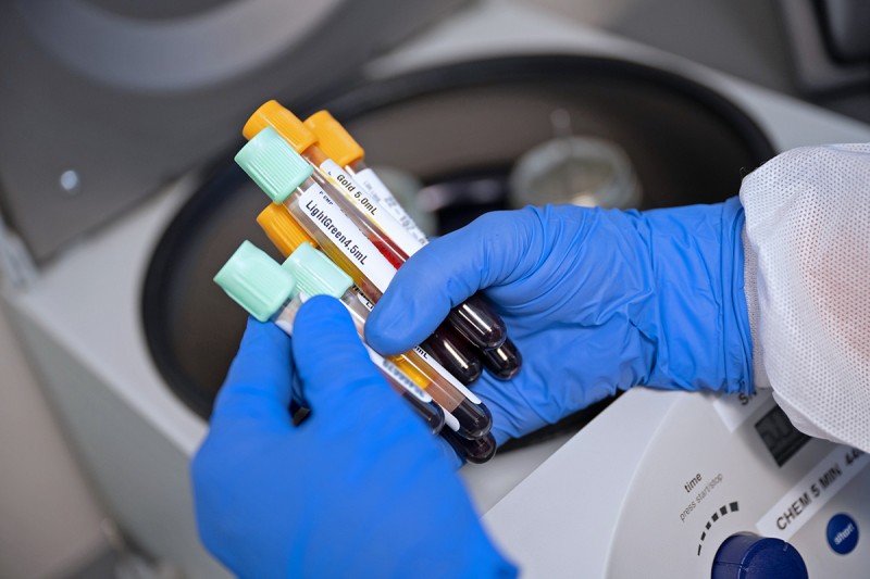 Blood samples being prepared for a centrifuge 