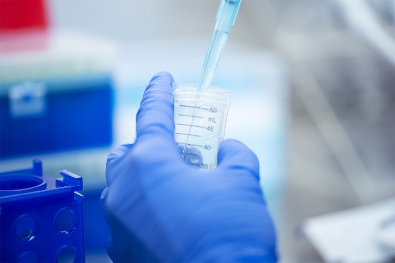 An MSK scientist pipettes in the lab