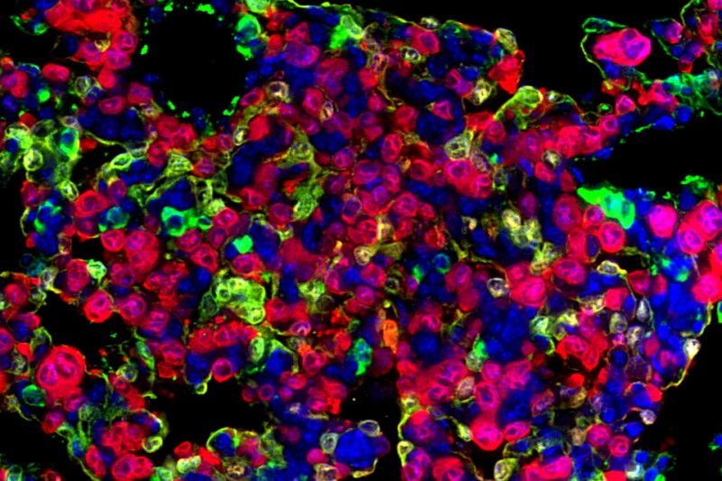 scientific image of mouse lung cancer cells 