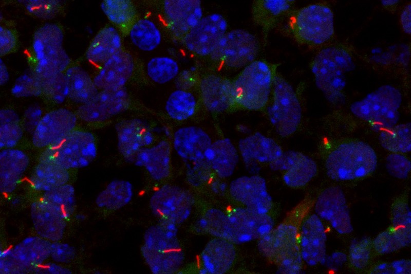 Magnified image of cells against a dark background, with primarily cilia highlighted in red