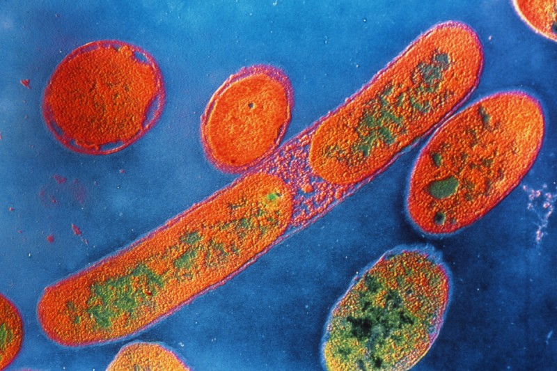 Pictured: Pseudomonas aeruginosa