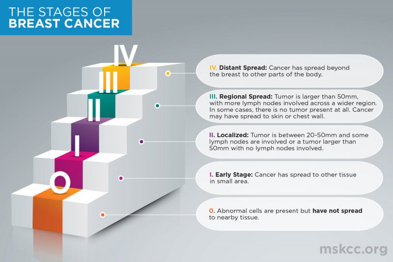 Breast Cancer Tumor Size Chart