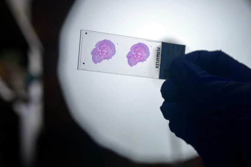 detail of a scientist holding up a slide