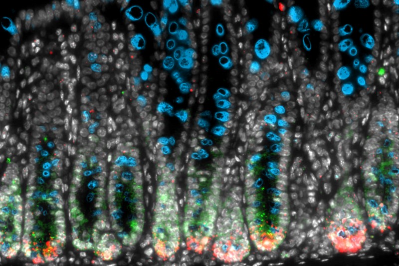 Microscope image of cells in a mouse colon