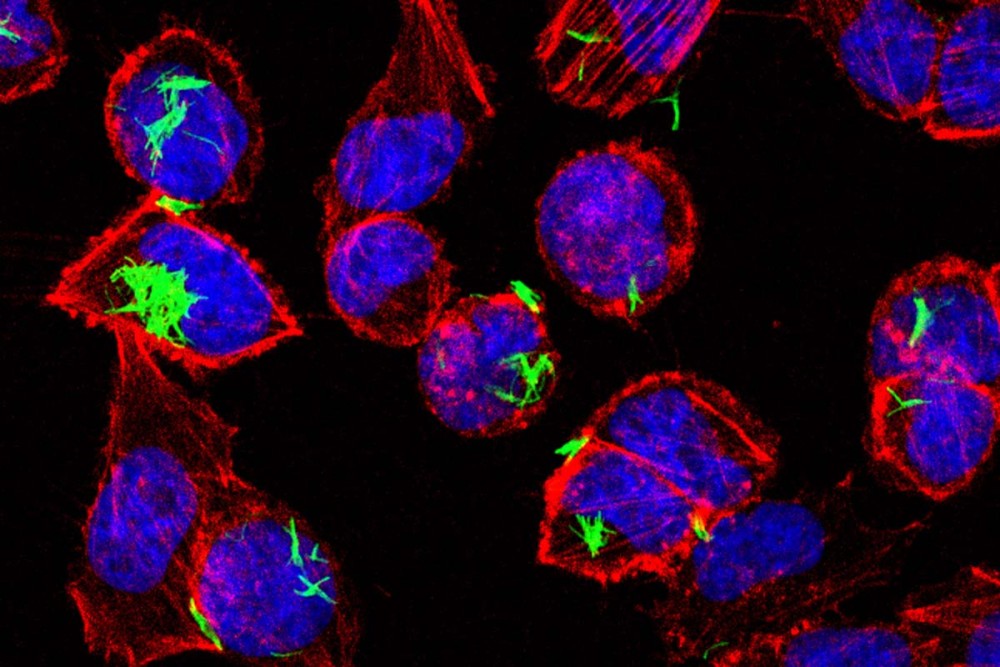 SKI Scientists Learn What Fuels the ‘Natural Killers’ of the Immune ...