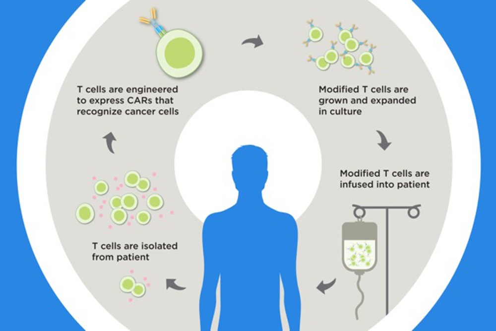 FDA Approves CAR T Cell Therapy for Non-Hodgkin Lymphoma | Memorial ...