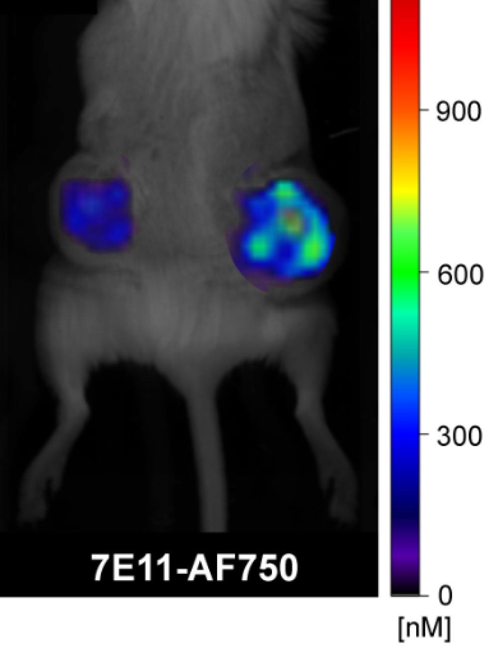 Prostate Cancer Imaging & Prostate-Specific Membrane Antigen (PSMA ...
