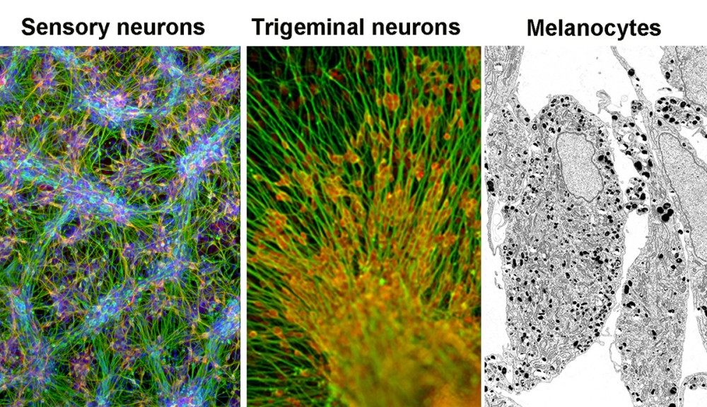 Directing Fate and Age of Human Pluripotent Stem Cells | Sloan ...