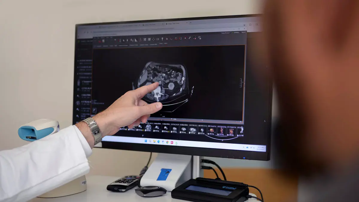 A MSK doctor’s hand points to an image on a monitor. 