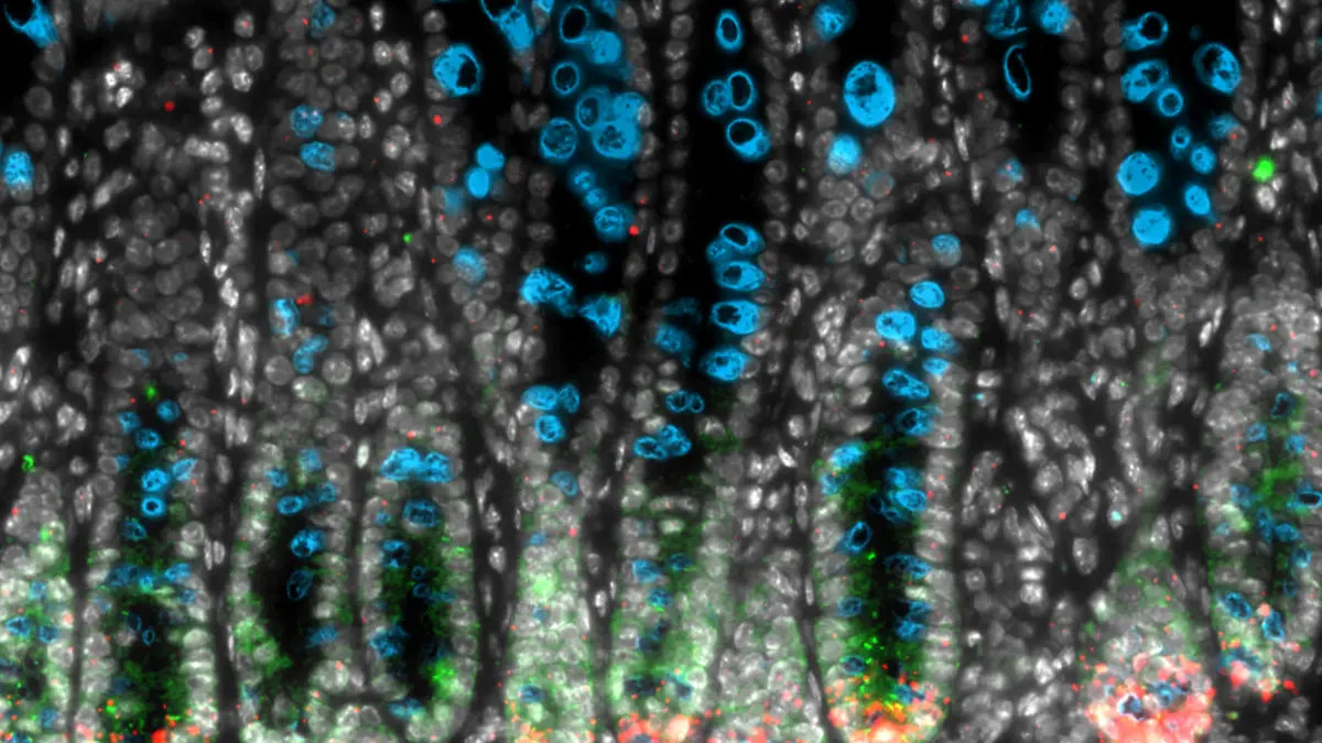 Microscope image of cells in a mouse colon