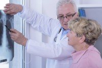 Doctor and patient looking at x-ray of lungs.