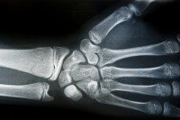 Hand x ray