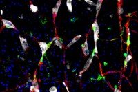 This image shows cancer cells (white) and pericytes (green) clinging to capillaries (red). The blue dots are nuclei.