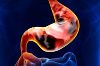 stomach illustration