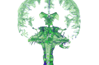 MRI of brain and spinal fluid in green